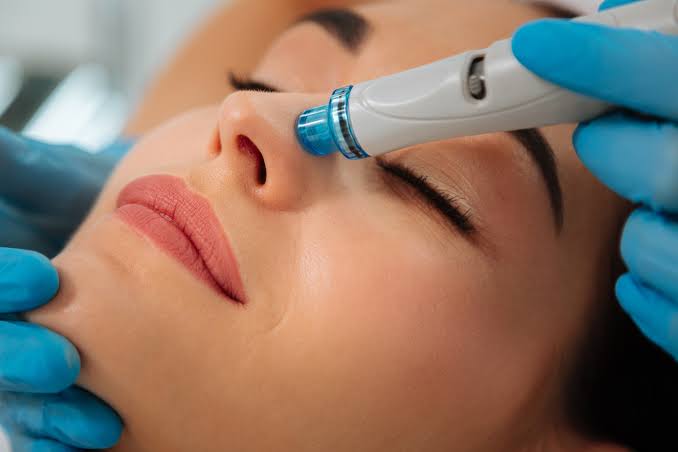 Nærbilde av HydraFacial-behandling rundt nesen