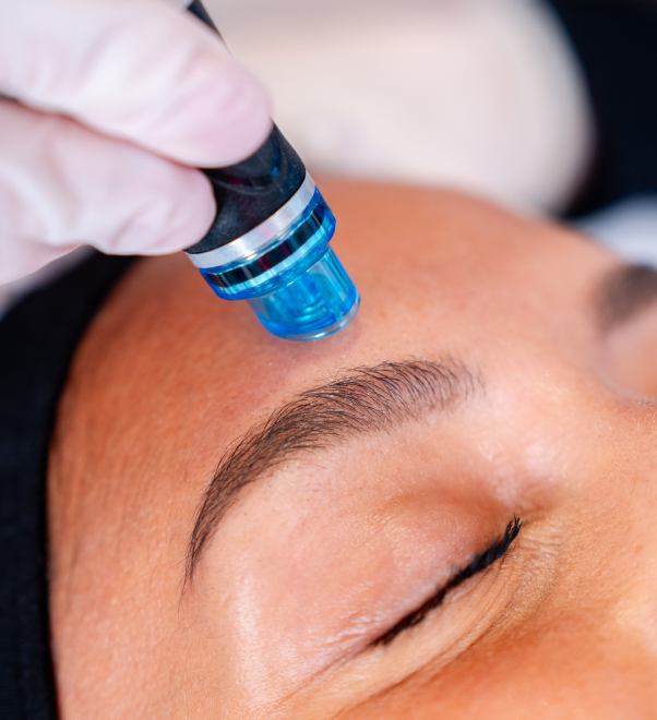 Nærbilde av HydraFacial-tips mot panne og øyebryn